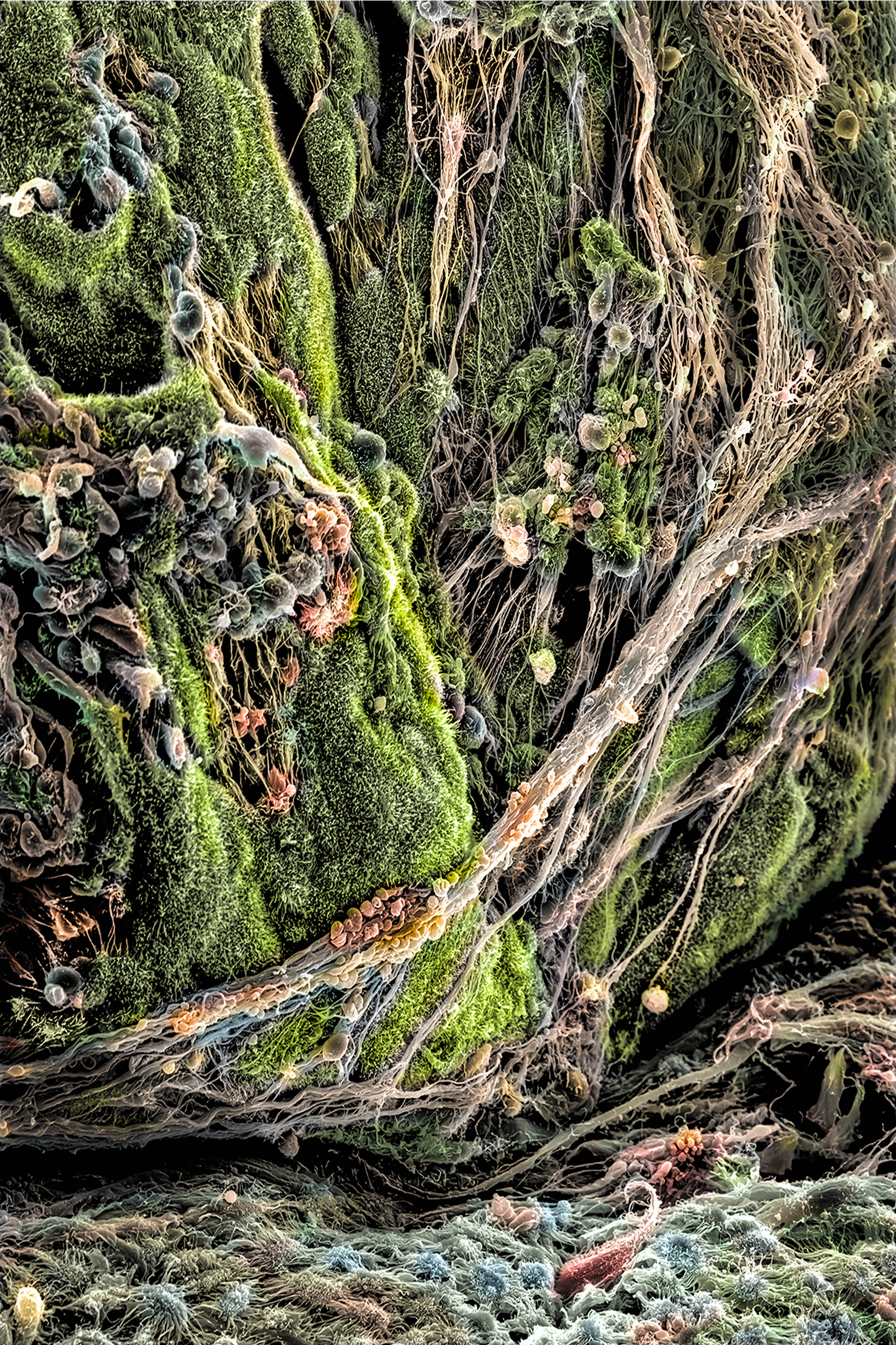 organoid_landscape_5