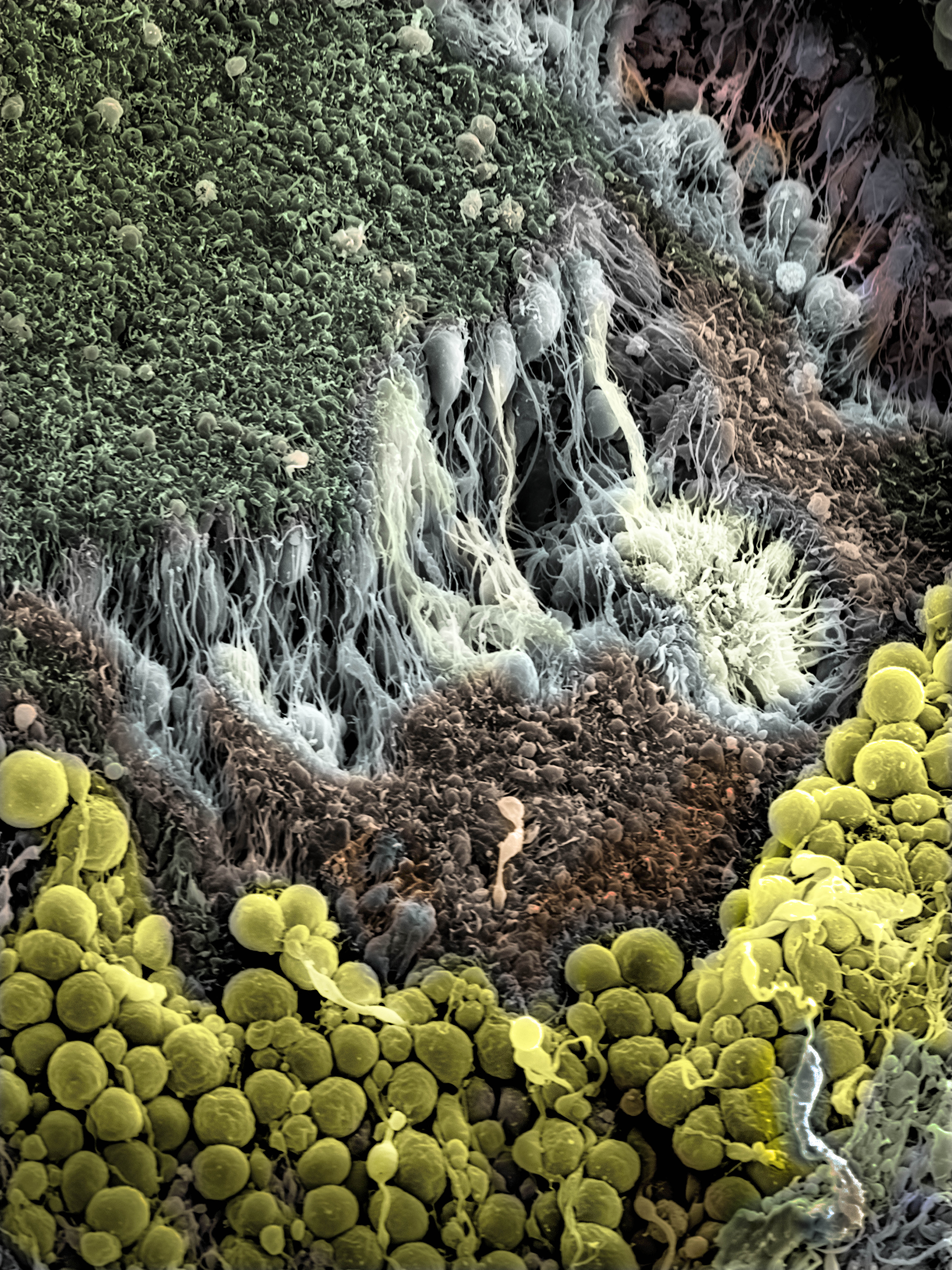 organoid_landscape_6_60x45